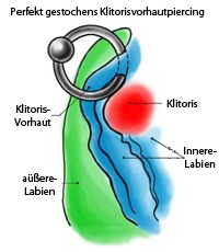 Klitorisvorhautpiercing vertikal pflege